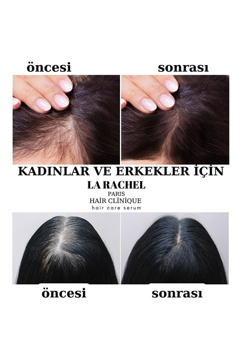 La Rachel Scientific Hair Serum  50ml LR1