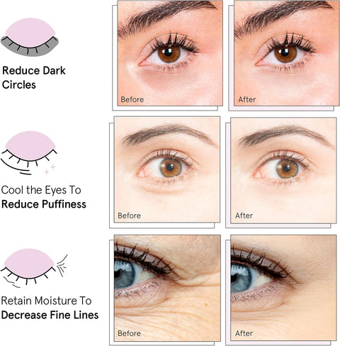 Grace & Stella Under Eye Gel Patches Multi-Color Pack |Grace & Stella In Lebanon